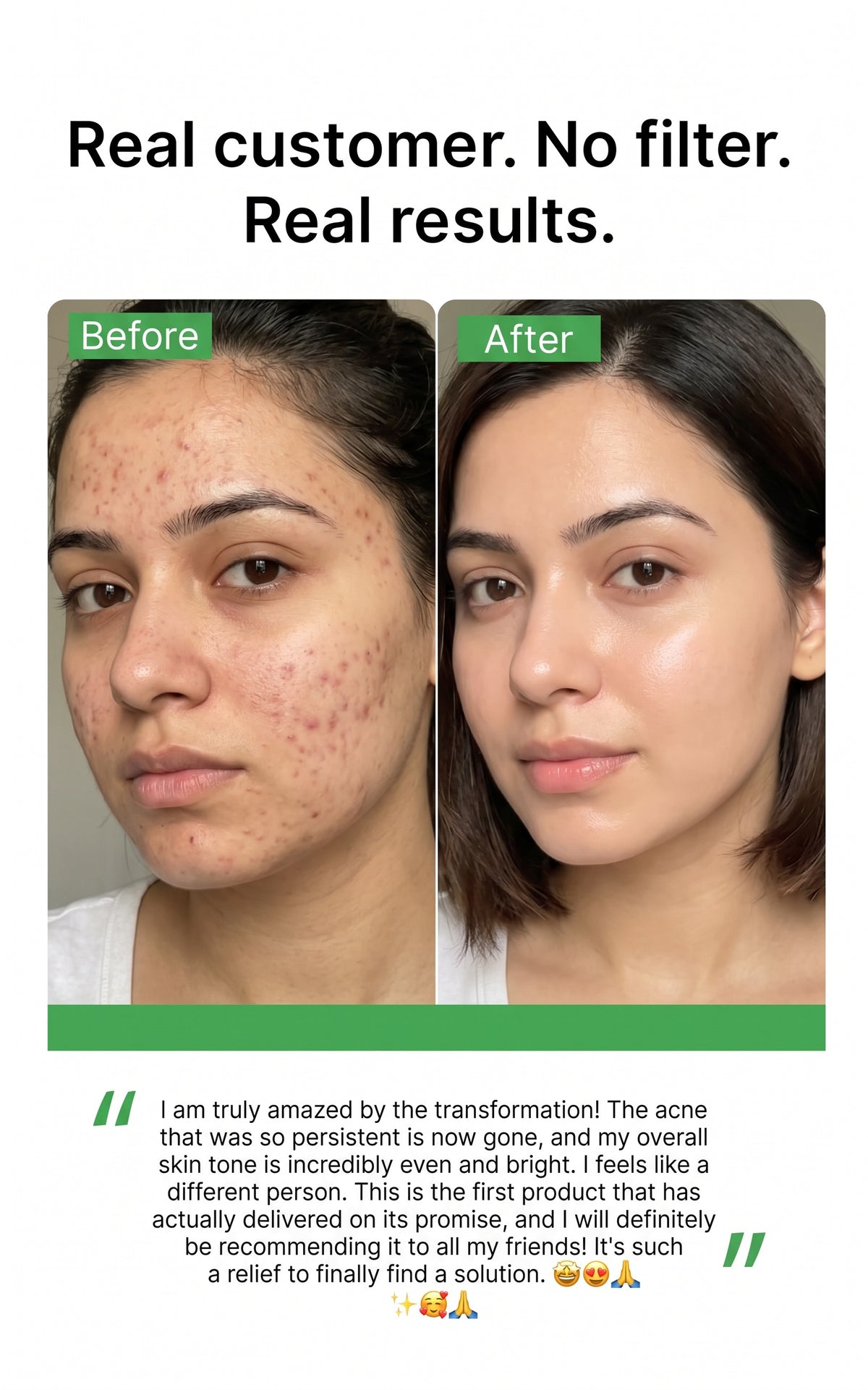 before after Kojic Acid Face Cream - 2%
review