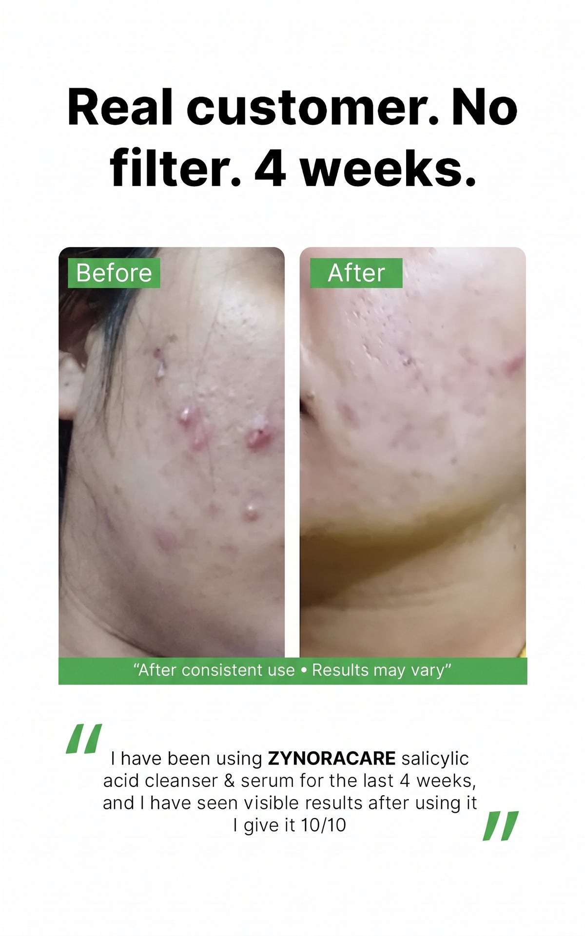 Salicylic Acid Face Wash review